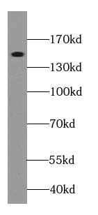 Western Blot: Integrin alpha D/CD11d Antibody - BSA Free [NBP3-47669] - Jurkat cells were subjected to SDS PAGE followed by western blot with (Integrin alpha D/CD11d antibody) at dilution of 1:800