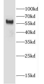 Western Blot: CCZ1 Antibody - BSA Free [NBP3-47670] - NIH/3T3 cells were subjected to SDS PAGE followed by western blot with ( CCZ1