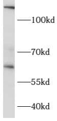 Western Blot: CCT6B Antibody - BSA Free [NBP3-47671] - Mouse testis were subjected to SDS PAGE followed by western blot with (CCT6B antibody) at dilution of 1:600