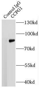 Immunoprecipitation: CPR8 Antibody - BSA Free [NBP3-47673] - IP Result of anti-CPR8 (IP:, 4ug; Detection: 1:500) with mouse brain tissue lysate 6000ug.