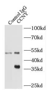 Immunoprecipitation: CCNY Antibody - BSA Free [NBP3-47674] - IP Result of anti-CCNY (IP:, 3ug; Detection: 1:600) with K-562 cells lysate 2400ug.