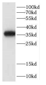 Western Blot: CCNY Antibody - BSA Free [NBP3-47674] - K-562 cells were subjected to SDS PAGE followed by western blot with (CCNY antibody) at dilution of 1:1000