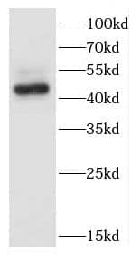 Western Blot: CCNL1 Antibody - BSA Free [NBP3-47675] - COLO 320 cells were subjected to SDS PAGE followed by western blot with (CCNL1 antibody) at dilution of 1:400