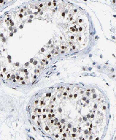 Immunohistochemistry CCHCR1 Antibody - BSA Free