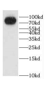 Western Blot CCHCR1 Antibody - BSA Free