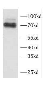 Western Blot: CCDC99 Antibody - BSA Free [NBP3-47678] - HEK-293 cells were subjected to SDS PAGE followed by western blot with (CCDC99 Antibody) at dilution of 1:1000