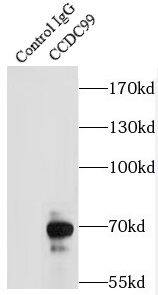 Immunoprecipitation: CCDC99 Antibody - BSA Free [NBP3-47678] - IP Result of anti-CCDC99 (IP:, 3ug; Detection: 1:1000) with HEK-293 cells lysate 920ug.