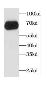Western Blot CCDC9 Antibody - BSA Free