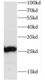 Western Blot CCDC85B Antibody - BSA Free