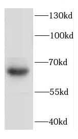Western Blot CCDC67 Antibody - BSA Free
