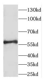 Western Blot: CCDC65 Antibody - BSA Free [NBP3-47684] - Mouse testis tissue were subjected to SDS PAGE followed by western blot with ( CCDC65 Antibody) at dilution of 1:1000