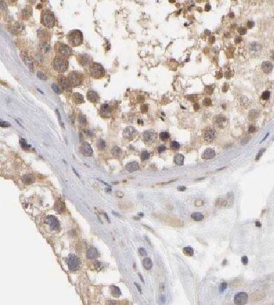 Immunohistochemistry CCDC62 Antibody - BSA Free