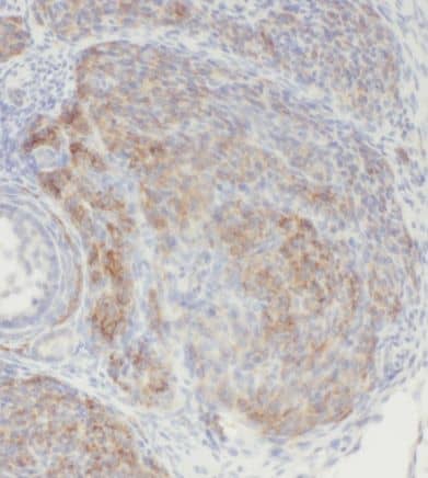 Immunohistochemistry: CCDC51 Antibody - BSA Free [NBP3-47688] - Immunohistochemistry of paraffin-embedded human ovary using (CCDC51 antibody) at dilution of 1:100