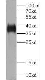 Western Blot: Ymer Antibody - BSA Free [NBP3-47689] - K-562 cells were subjected to SDS PAGE followed by western blot with (CCDC50 antibody) at dilution of 1:500