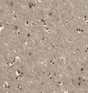 Immunohistochemistry CCDC42 Antibody - BSA Free