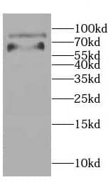 Western Blot: CCDC41 Antibody - BSA Free [NBP3-47691] - HEK-293 cells were subjected to SDS PAGE followed by western blot with ( CCDC41 Antibody) at dilution of 1:600