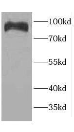 Western Blot CCDC40 Antibody - BSA Free