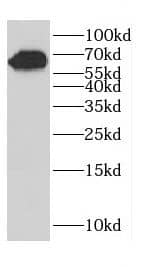 Western Blot: CCDC120 Antibody - BSA Free [NBP3-47699] - Jurkat cells were subjected to SDS PAGE followed by western blot with (CCDC120 antibody) at dilution of 1:500