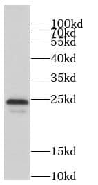 Western Blot: CCDC115 Antibody - BSA Free [NBP3-47701] - Mouse brain tissue were subjected to SDS PAGE followed by western blot with (CCDC115 antibody) at dilution of 1:300