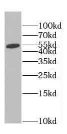 Western Blot: CCDC105 Antibody - BSA Free [NBP3-47702] - DU 145 cells were subjected to SDS PAGE followed by western blot with (CCDC105 antibody) at dilution of 1:1000