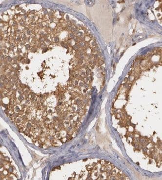 Immunohistochemistry: CCDC105 Antibody - BSA Free [NBP3-47702] - Immunohistochemistry of paraffin-embedded human testis tissue slide using (CCDC105 Antibody) at dilution of 1:50