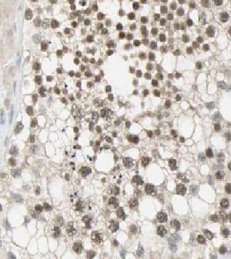 Immunohistochemistry: CCDC104 Antibody - BSA Free [NBP3-47703] - Immunohistochemistry of paraffin-embedded human testis slide using (CCDC104 Antibody) at dilution of 1:50