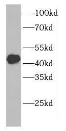Western Blot: CCDC104 Antibody - BSA Free [NBP3-47703] - Mouse lung tissues were subjected to SDS PAGE followed by western blot with (CCDC104 Antibody) at dilution of 1:1000
