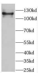 Western Blot: CC2D1B Antibody - BSA Free [NBP3-47706] - Mouse brain tissue were subjected to SDS PAGE followed by western blot with (CC2D1B antibody) at dilution of 1:500