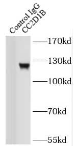 Immunoprecipitation CC2D1B Antibody - BSA Free