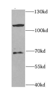 Western Blot: CBLB Antibody - BSA Free [NBP3-47709] - HEK-293 cells were subjected to SDS PAGE followed by western blot with (CBLB antibody) at dilution of 1:1000