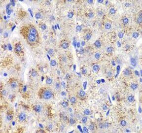 Immunohistochemistry: CBLB Antibody - BSA Free [NBP3-47709] - Immunohistochemistry of paraffin-embedded human liver injury using (CBLB antibody) at dilution of 1:100