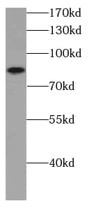 Western Blot: ATPGD1 Antibody - BSA Free [NBP3-47710] - HeLa cells were subjected to SDS PAGE followed by western blot with ( ATPGD1 antibody) at dilution of 1:300