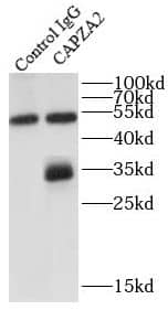 Immunoprecipitation: CAPZA2 Antibody - BSA Free [NBP3-47714] - IP Result of anti-CAPZA2 (IP:, 4ug; Detection: 1:800) with mouse heart tissue lysate 4000ug.