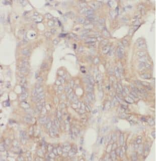 Immunohistochemistry CAPZA2 Antibody - BSA Free