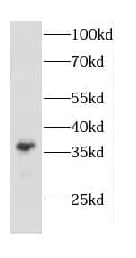 Western Blot: CAPZA2 Antibody - BSA Free [NBP3-47714] - Mouse brain tissue were subjected to SDS PAGE followed by western blot with (CAPZA2 Antibody) at dilution of 1:1000