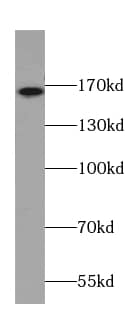 Western Blot: CAMSAP1L1 Antibody - BSA Free [NBP3-47716] - Mouse brain tissue were subjected to SDS PAGE followed by western blot with (CAMSAP1L1 antibody) at dilution of 1:500