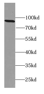 Western Blot: Calpain 7 Antibody - BSA Free [NBP3-47718] - Mouse brain tissue were subjected to SDS PAGE followed by western blot with ( Calpain 7