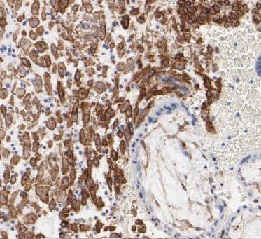 Immunohistochemistry Calpain 6 Antibody - BSA Free