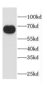Western Blot Calpain 6 Antibody - BSA Free