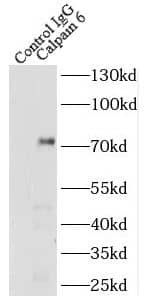 Immunoprecipitation Calpain 6 Antibody - BSA Free