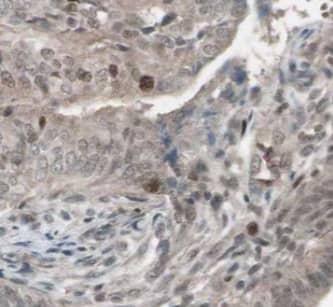 Immunohistochemistry CAPS2 Antibody - BSA Free