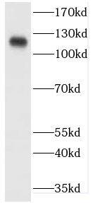 Western Blot: Cadherin-20 Antibody - BSA Free [NBP3-47725] - HeLa cells were subjected to SDS PAGE followed by western blot with (Cadherin-20 antibody) at dilution of 1:1000