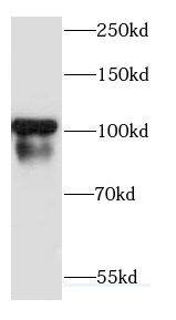 Western Blot: Cadherin-18 Antibody - BSA Free [NBP3-47726] - COLO 320 cells were subjected to SDS PAGE followed by western blot with (Cadherin-18 antibody) at dilution of 1:300