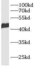 Western Blot: CACNG7 Antibody - BSA Free [NBP3-47727] - HepG2 cells were subjected to SDS PAGE followed by western blot with (CACNG7 antibody) at dilution of 1:600