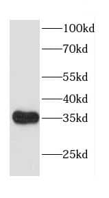 Western Blot: CACNG5 Antibody - BSA Free [NBP3-47728] - SH-SY5Y cells were subjected to SDS PAGE followed by western blot with (CACNG5 antibody) at dilution of 1:300