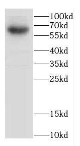Western Blot: CACNB4 Antibody - BSA Free [NBP3-47730] - Rat brain tissue were subjected to SDS PAGE followed by western blot with (CACNB4 antibody) at dilution of 1:1000