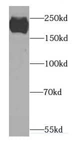 Western Blot: CACNA1S Antibody - BSA Free [NBP3-47731] - Human brain tissue were subjected to SDS PAGE followed by western blot with (CACNA1S antibody) at dilution of 1:1000