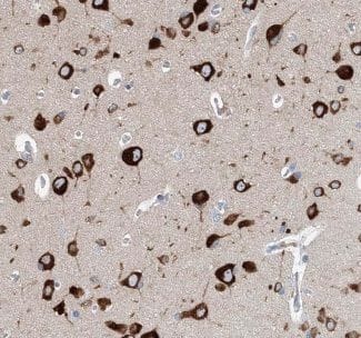 Immunohistochemistry Cav2.2 Antibody - BSA Free