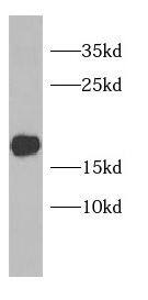 Western Blot: PLGRKT Antibody - BSA Free [NBP3-47736] - A431 cells were subjected to SDS PAGE followed by western blot with ( PLGRKT Antibody) at dilution of 1:1000