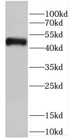 Western Blot: CARNMT1 Antibody - BSA Free [NBP3-47737] - HepG2 cells were subjected to SDS PAGE followed by western blot with (CARNMT1 antibody) at dilution of 1:1000